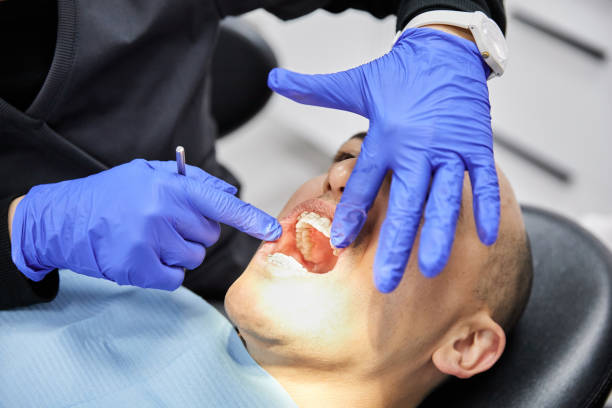 Best Emergency Dental Extractions in Muttontown, NY